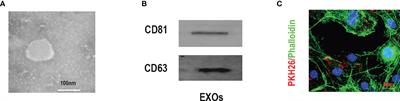 BMSC-Derived Exosomes Inhibit Dexamethasone-Induced Muscle Atrophy via the miR-486-5p/FoxO1 Axis